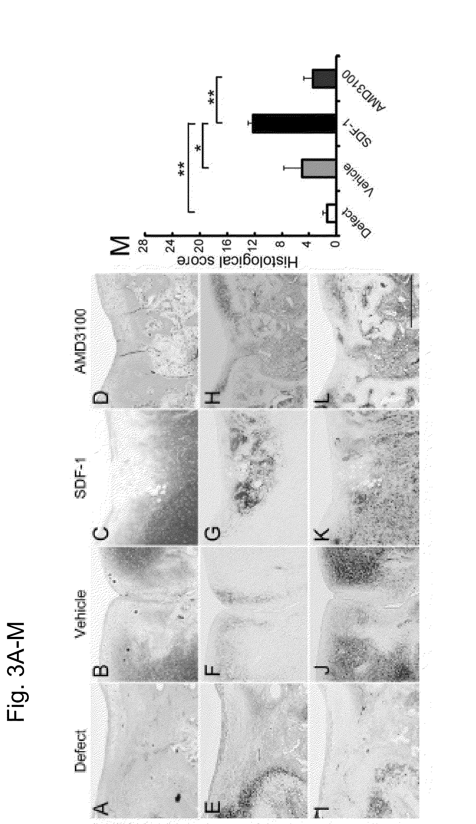 Composition for regeneration of cartilage