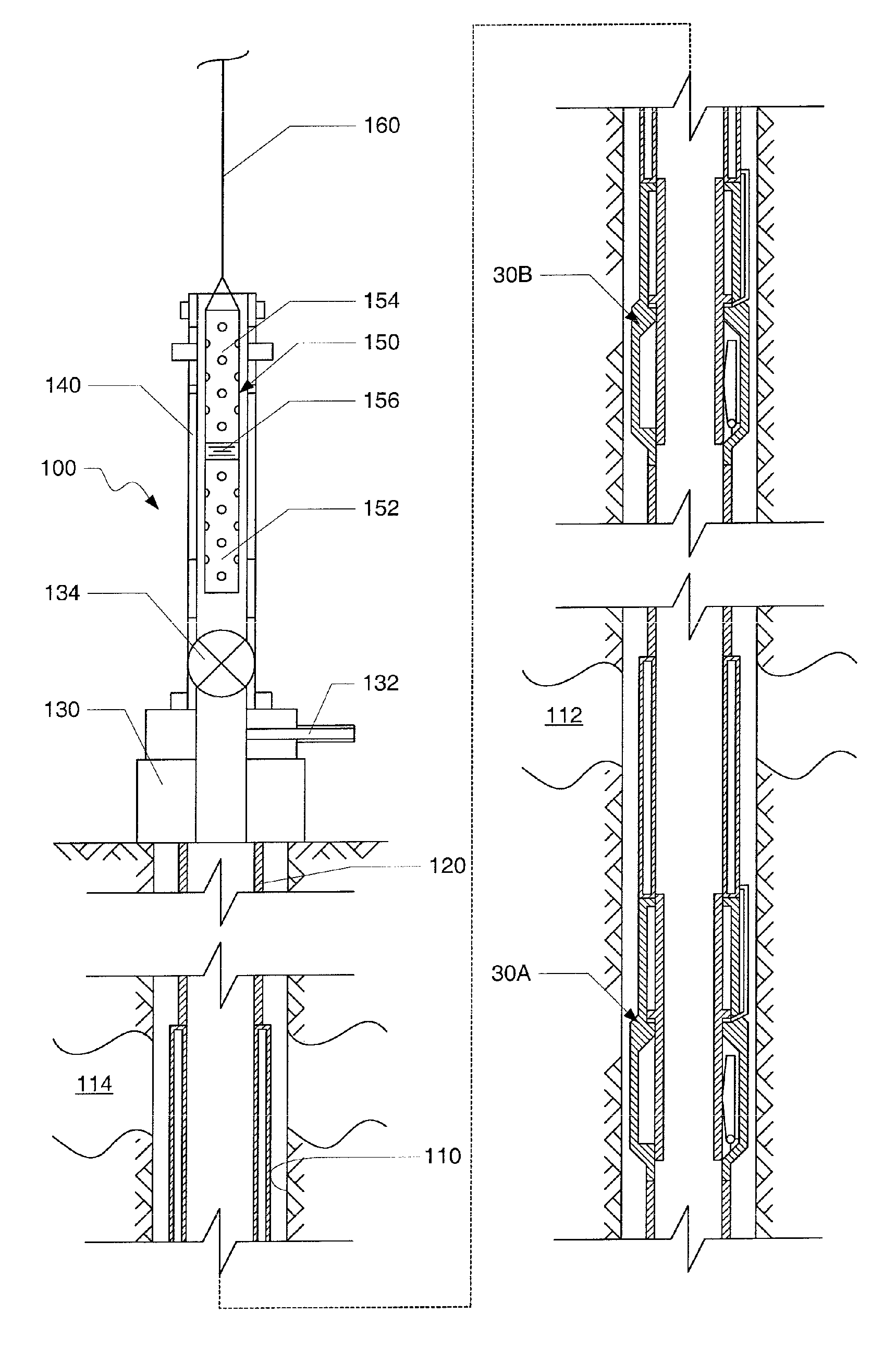 System and method for completing multiple well intervals