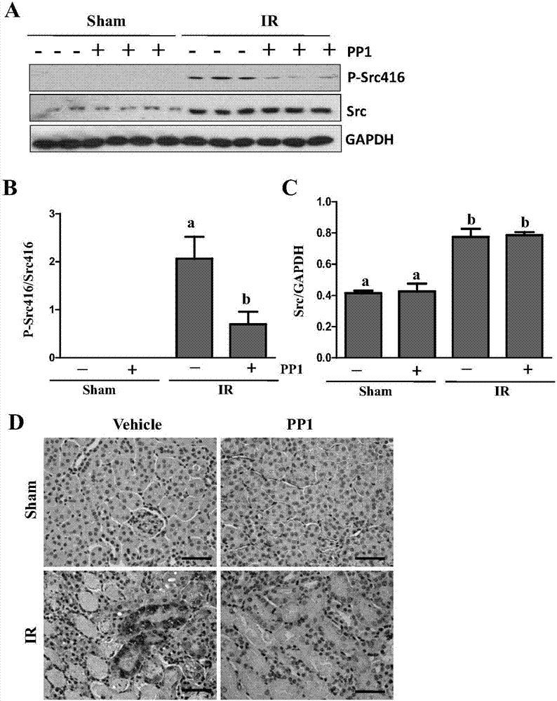 Application of Src kinase inhibitor in preparing medicaments for treating acute kidney injury