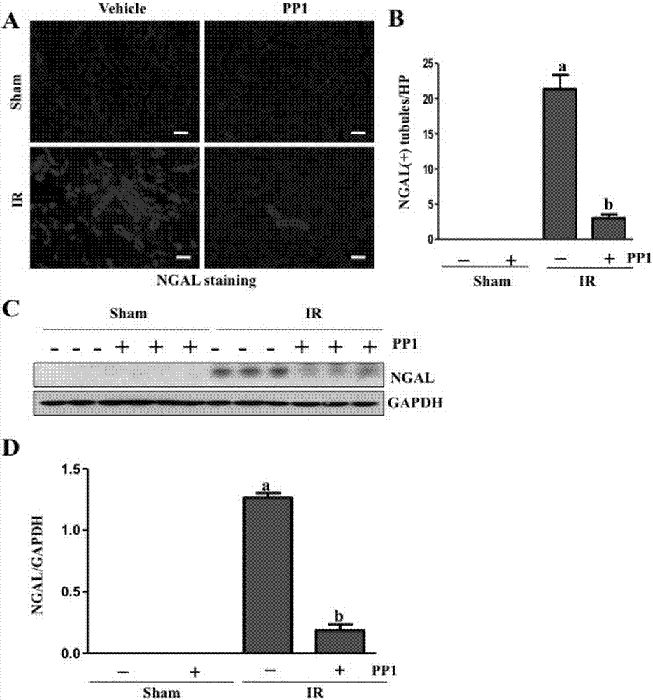 Application of Src kinase inhibitor in preparing medicaments for treating acute kidney injury