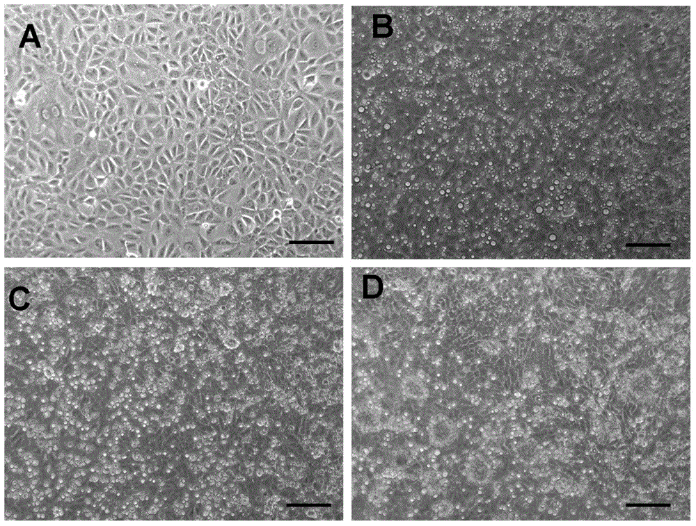 Separation culture method for chick germinal crescent source PGCs