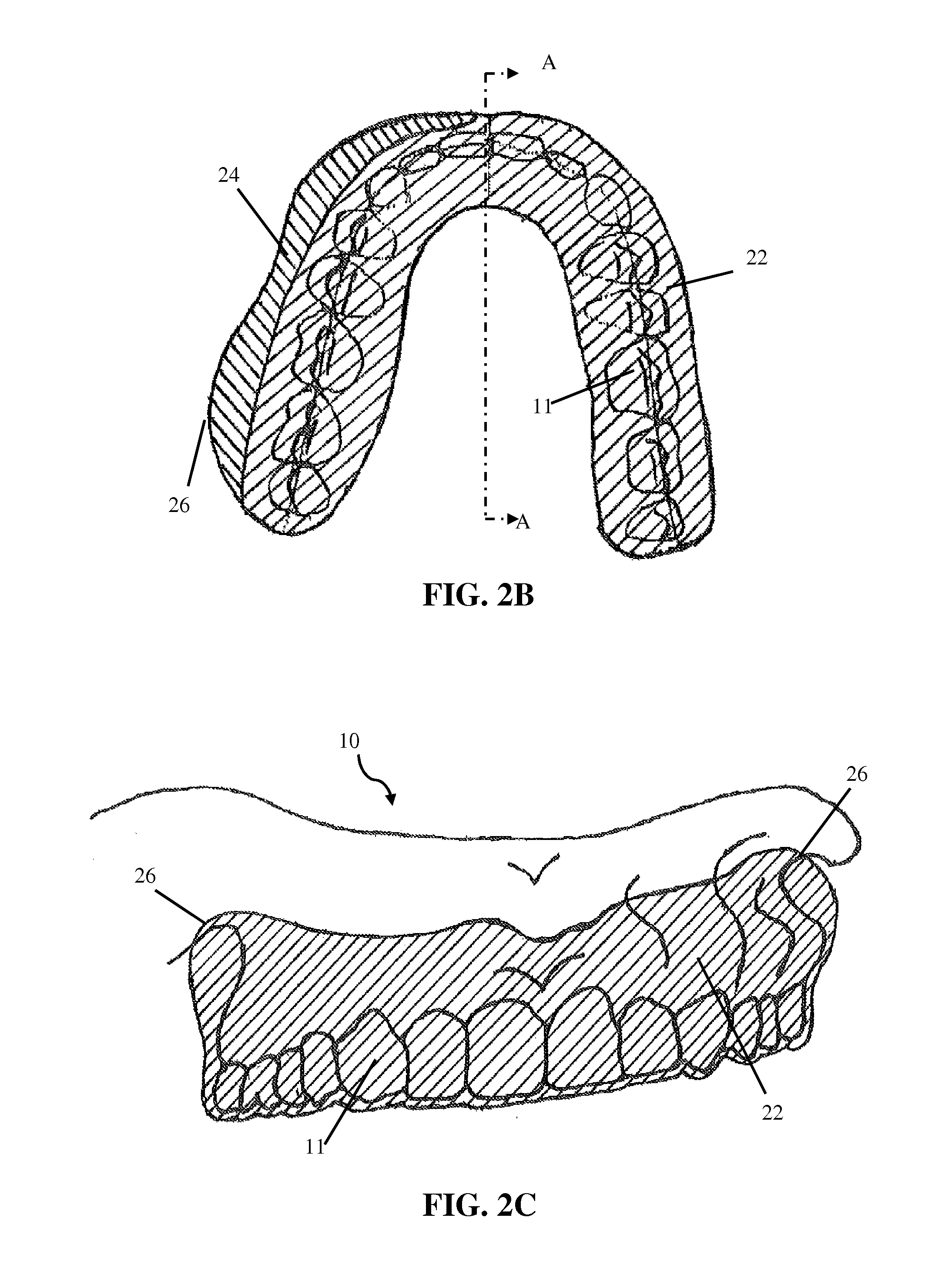 Intra-oral appliance and methods of using same