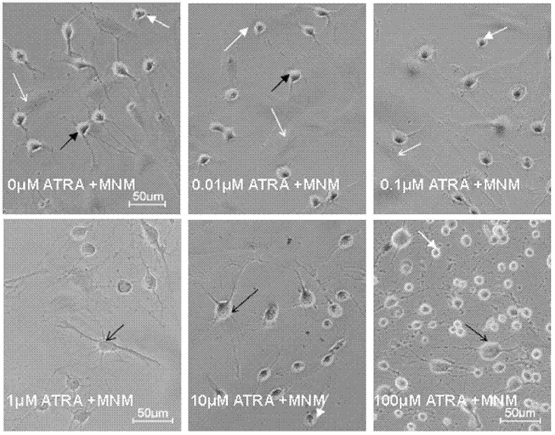 Method for inducing neural differentiation of stem cells