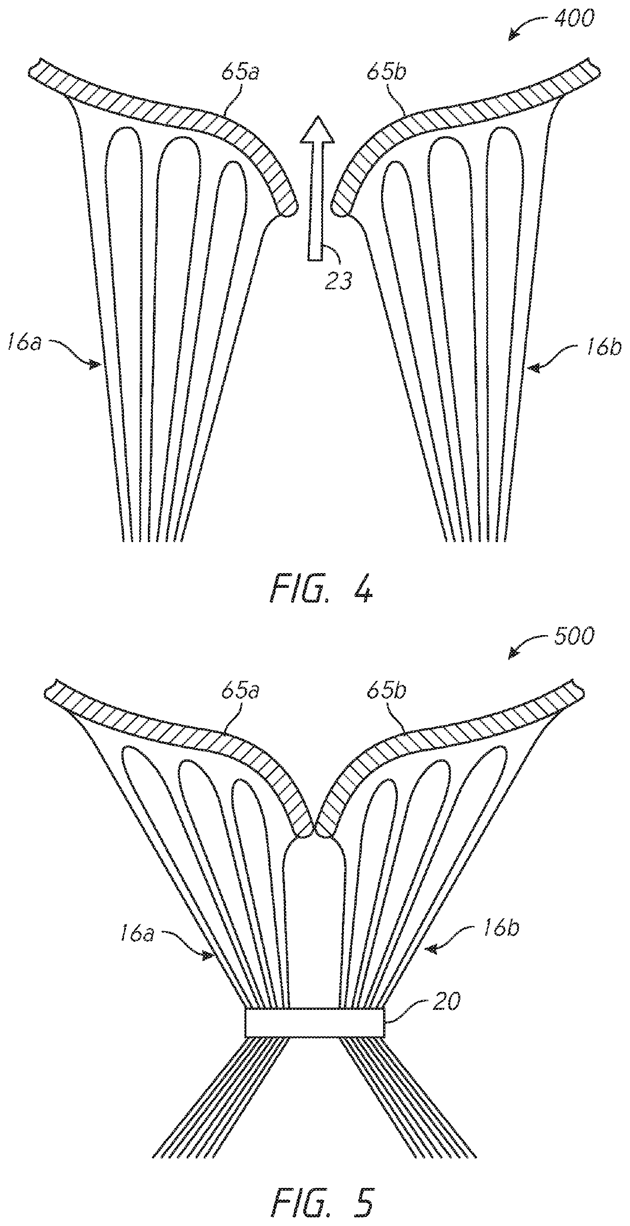 Chordae tendineae adjustment