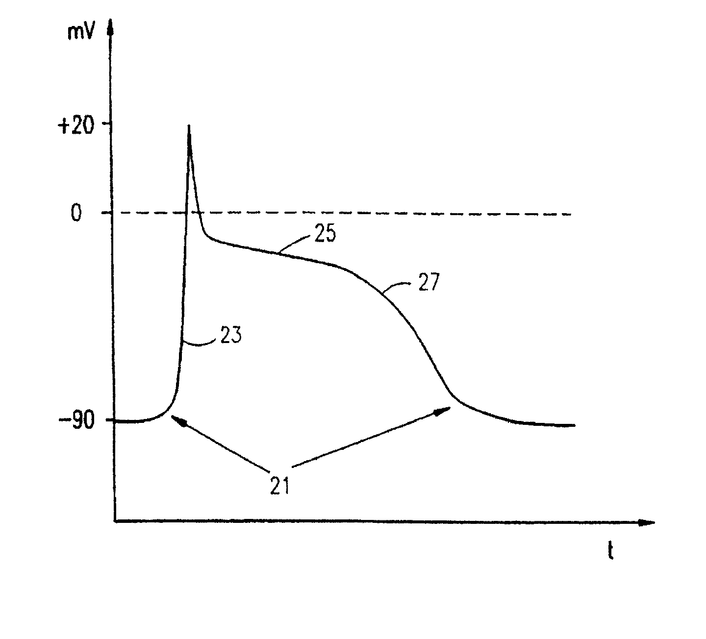 Electrical muscle controller