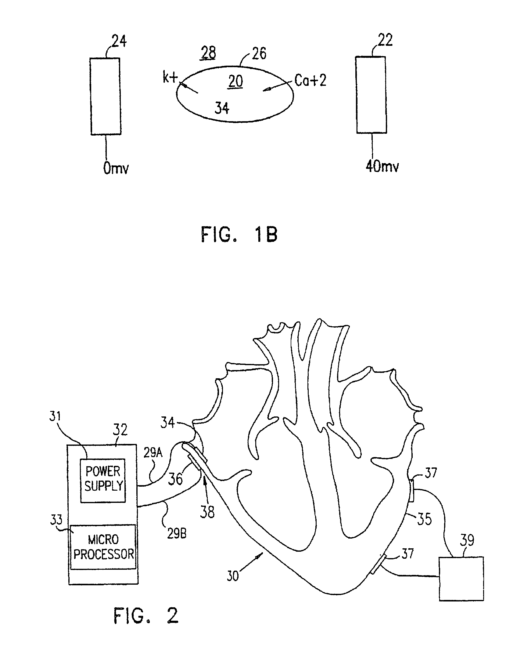 Electrical muscle controller