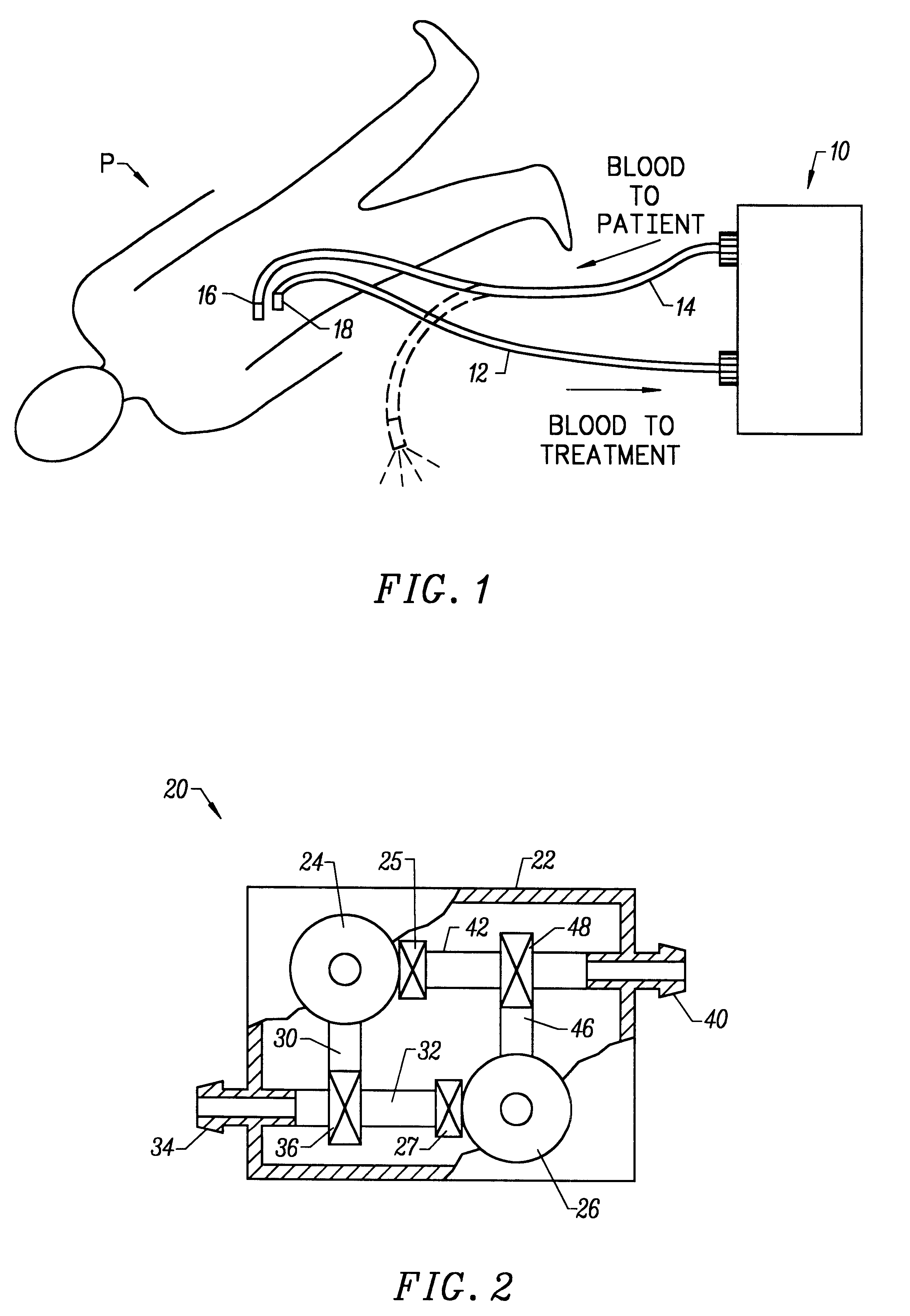 Valve port assembly with interlock