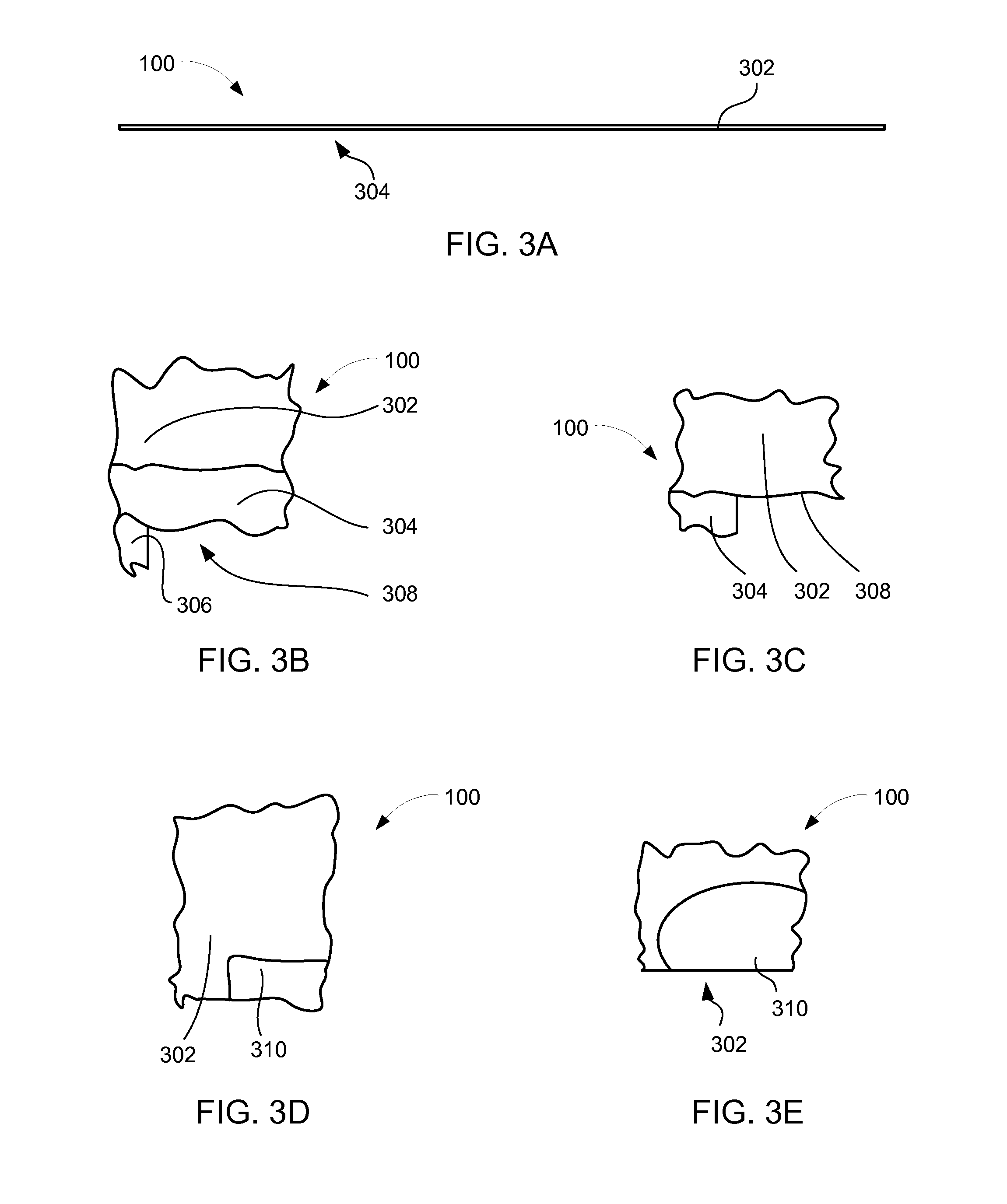 Integrated circuit system with stress redistribution layer and method of manufacture thereof