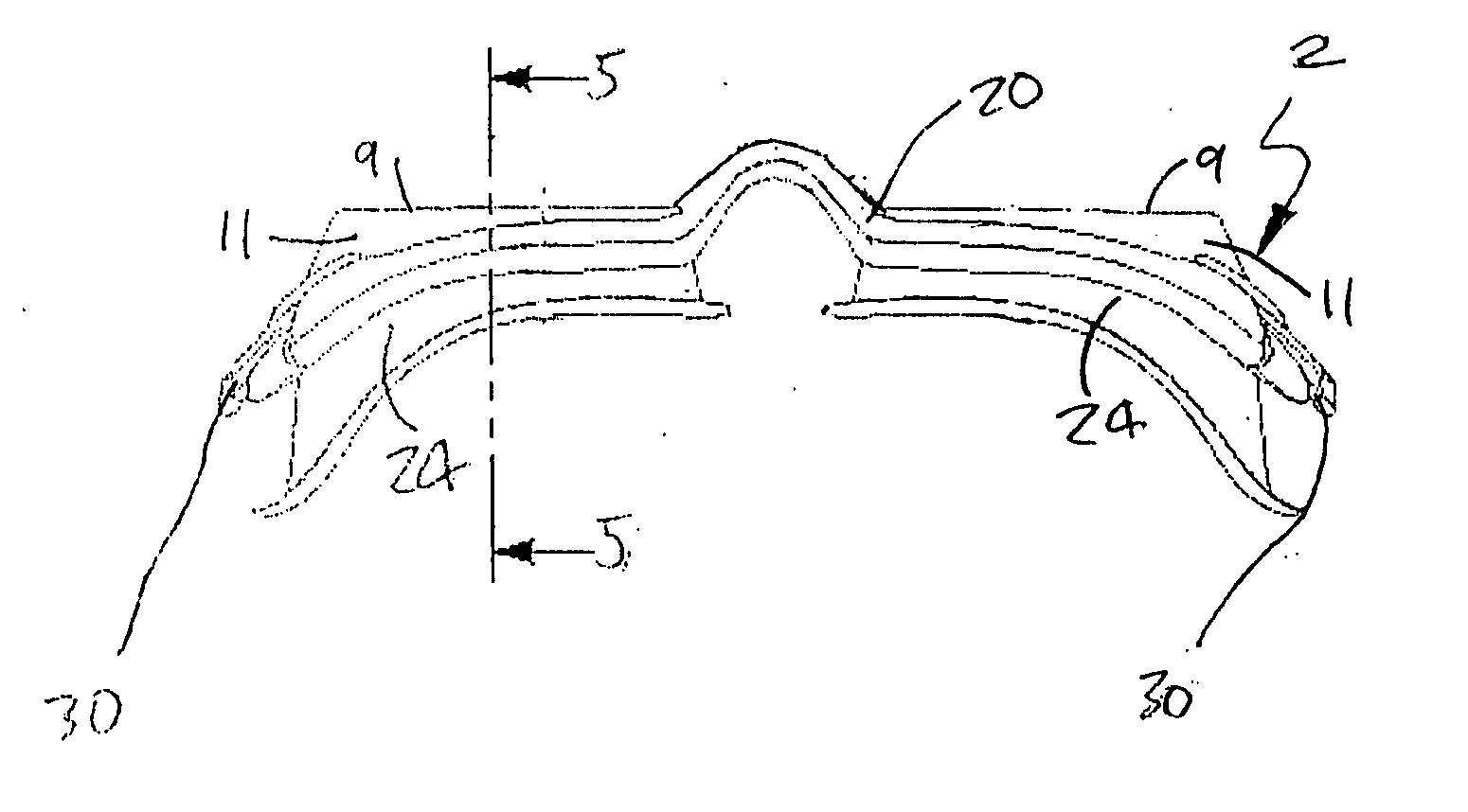 Eye goggles with unitary internal skeleton and overmoulded covering