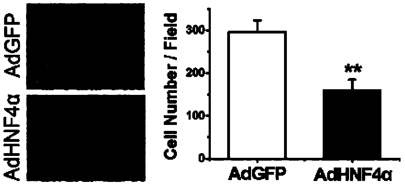 Application of HNF4 (hepatocyte nuclear factor 4) alpha proteins to preparation of liver cancer prognosis evaluation kit