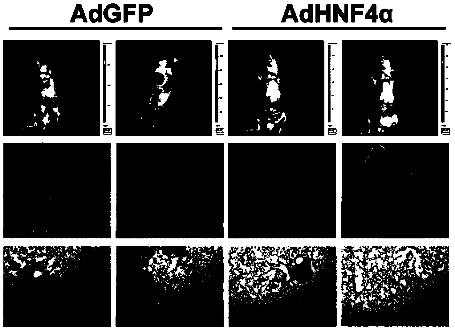 Application of HNF4 (hepatocyte nuclear factor 4) alpha proteins to preparation of liver cancer prognosis evaluation kit