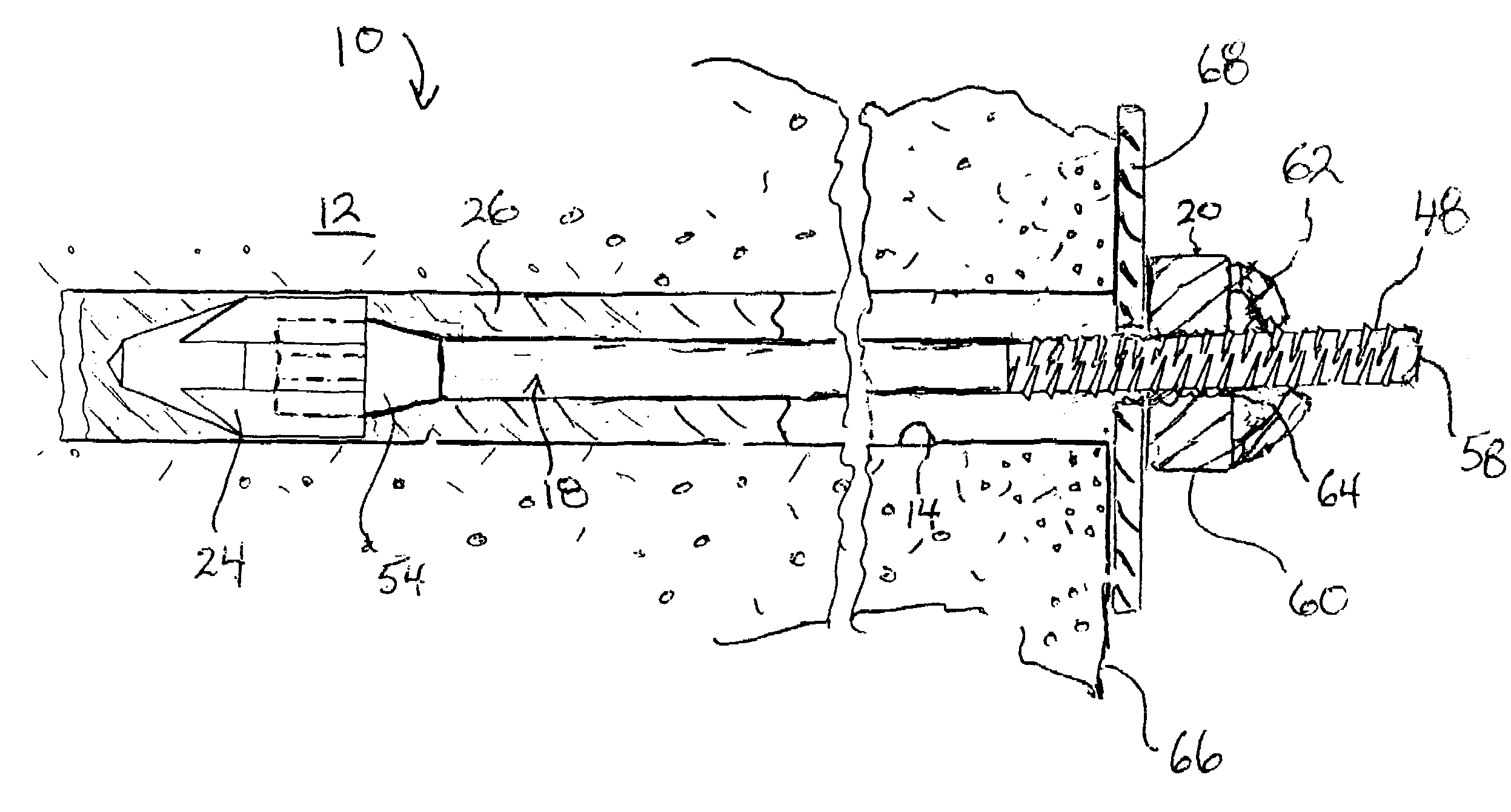 Detachable anchor bolt mixing head for use in mine roof support systems and method of using same