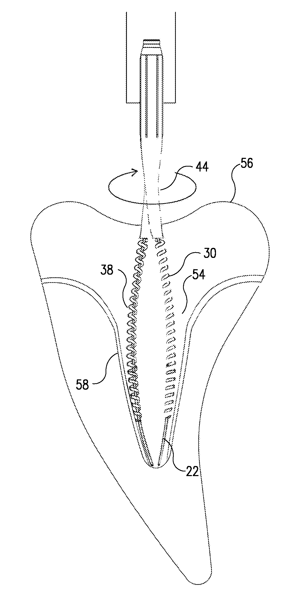 Rotary endodontic file with frictional grip