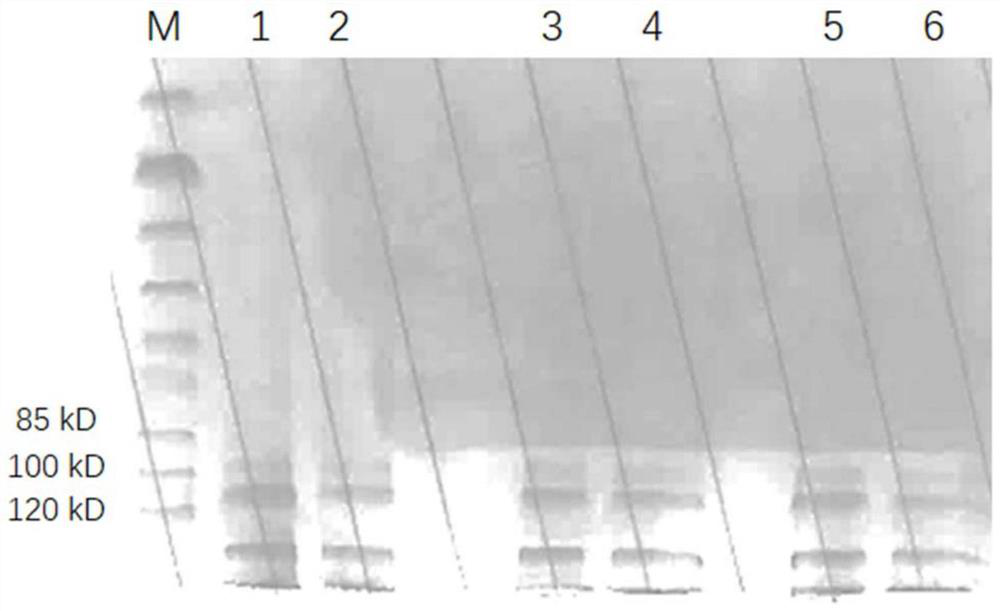 A kind of sterile instant undenatured natural collagen freeze-dried product and its preparation method