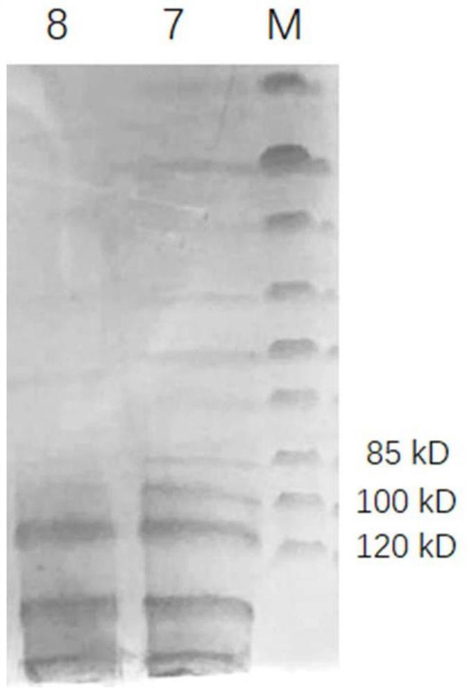 A kind of sterile instant undenatured natural collagen freeze-dried product and its preparation method