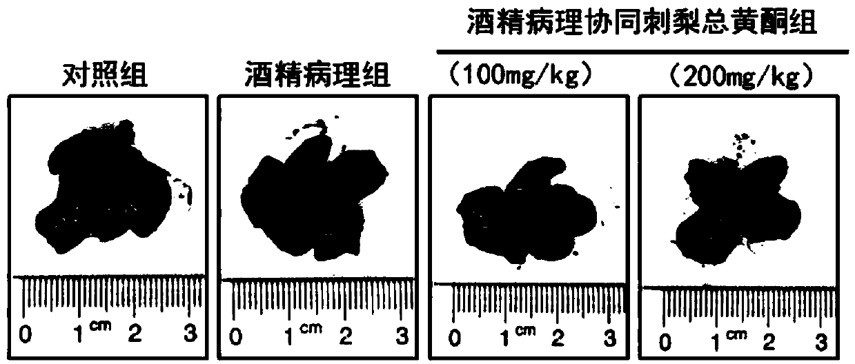 Application of total flavonoids of rosa roxburghii