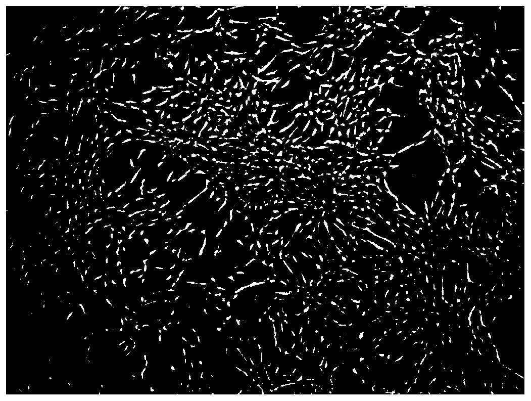 Umbilical cord Wharton's jelly mesenchymal stem cell osteogenic directional differentiation method