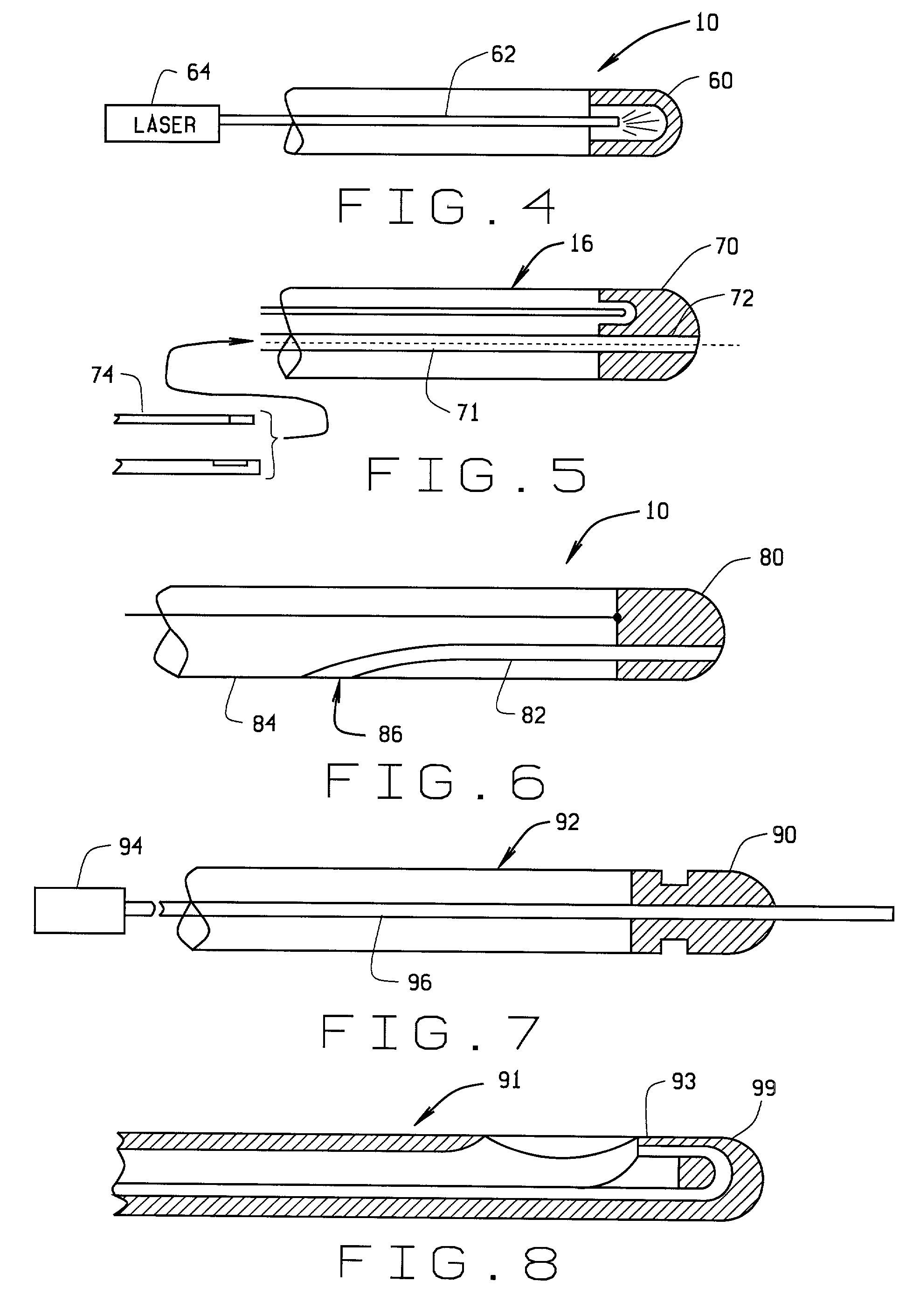 Magnetically guided atherectomy