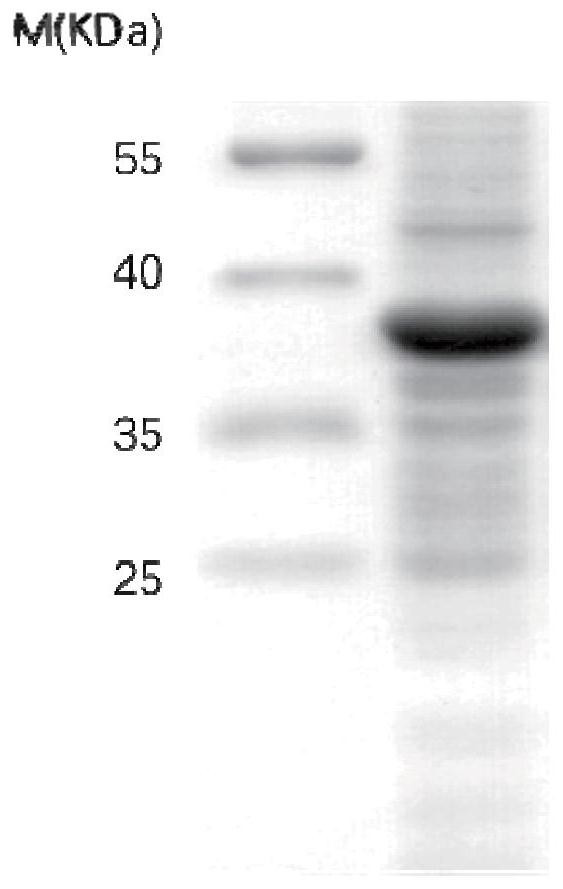 Application of copper gluconate in preparation of a medicine for preventing or treating novel coronavirus infection