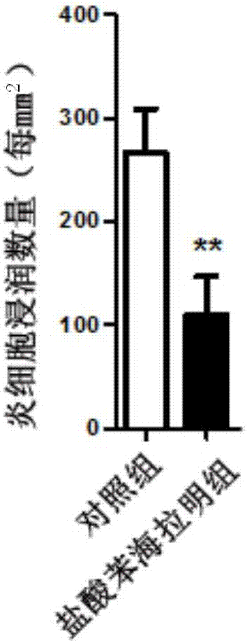 Application of diphenhydramine hydrochloride in preparation of medicine for treating experimental autoimmune encephalomyelitis