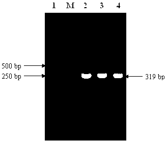 Universal RT-PCR (Reverse Transcription Polymerase Chain Reaction) detection primer and detection method for avian pneumovirus