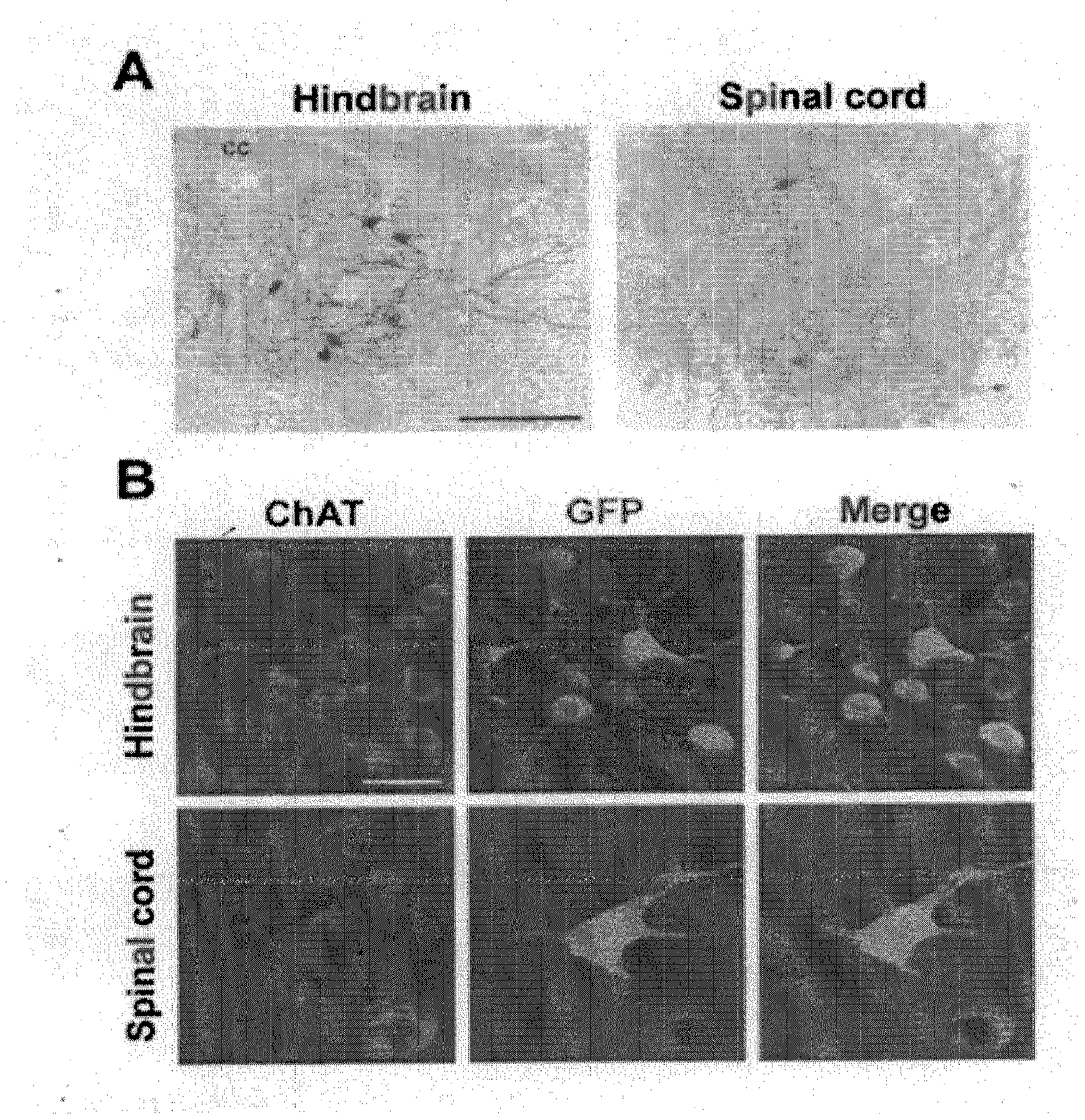 Retrograde transport viral vector system having envelope comprising fused glycoprotein