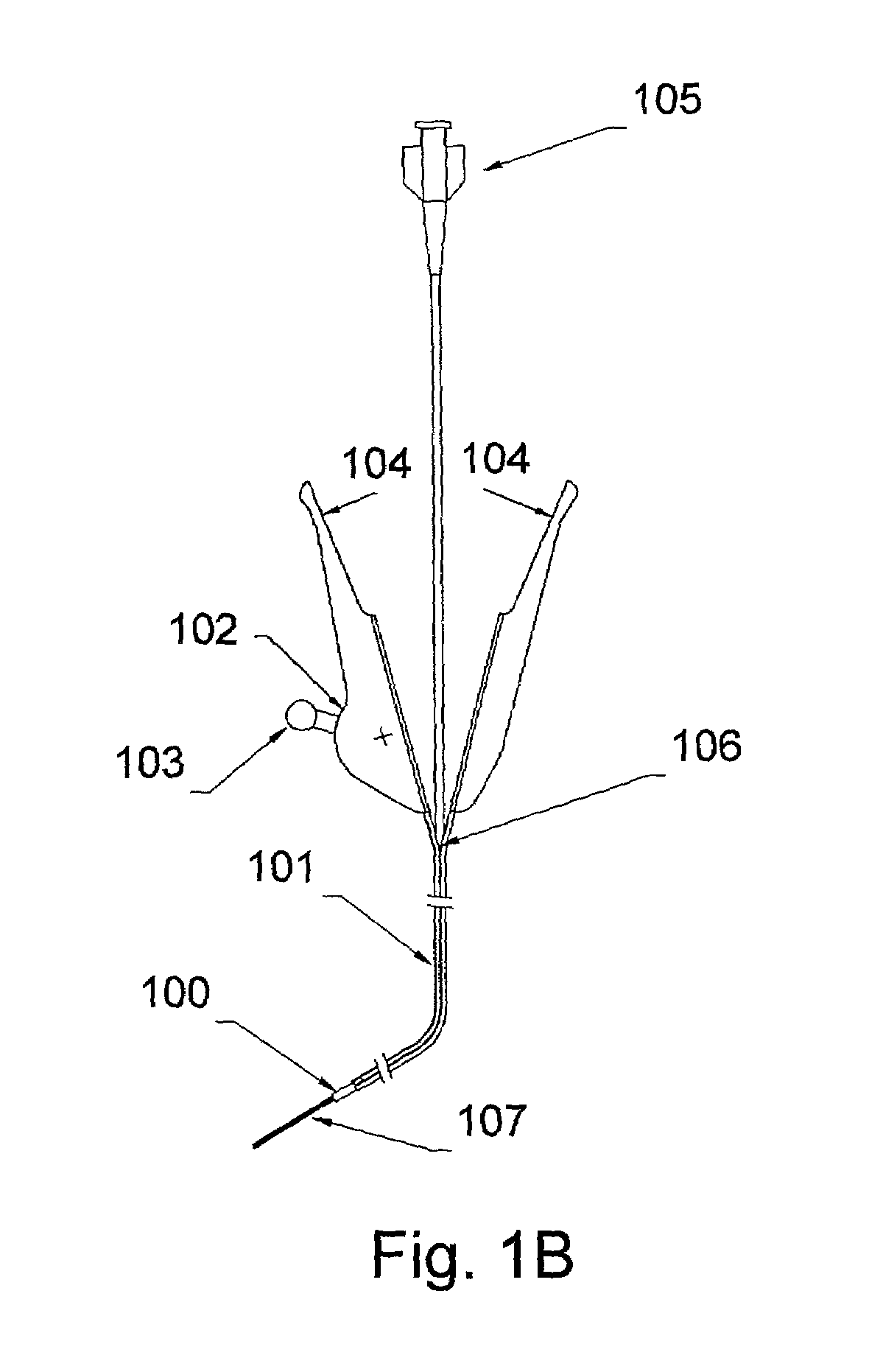 Telescoping guide catheter with peel-away outer sheath