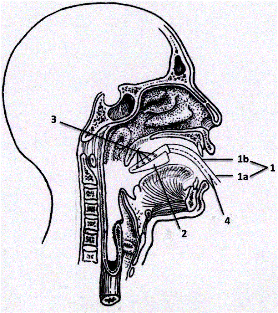 Intraoral coil for high-resolution intracranial artery imaging