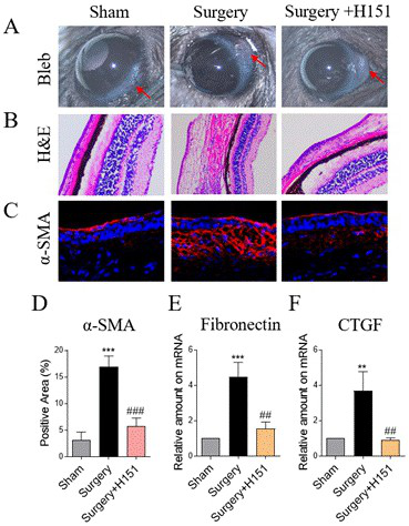 Application of STING inhibitor in preparation of anti-filtration channel conjunctival cicatrization treatment medicine