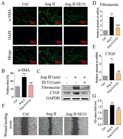 Application of STING inhibitor in preparation of anti-filtration channel conjunctival cicatrization treatment medicine