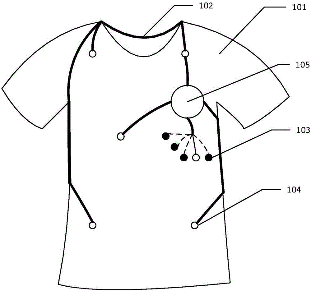 Electrocardiogram monitoring device