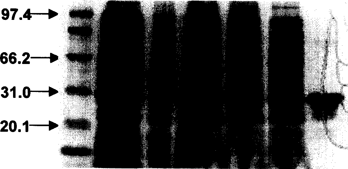 HIV-1 yesisting polypeptide C22, its coding sequence and prepn process