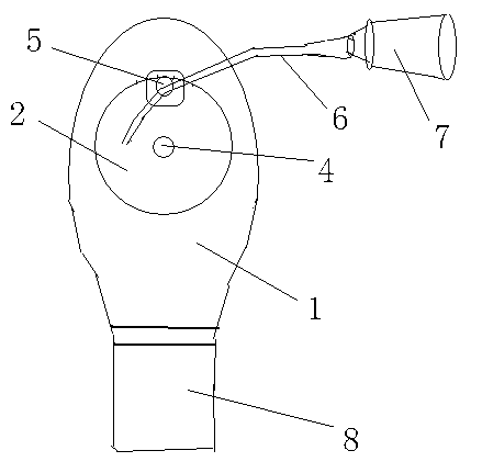 Easy-to-wash movable stoma bag