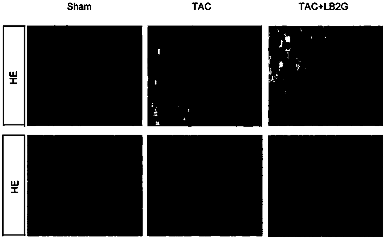 Application of benzimidazole derivatives in preparation of medicines for treating congestive heart failure