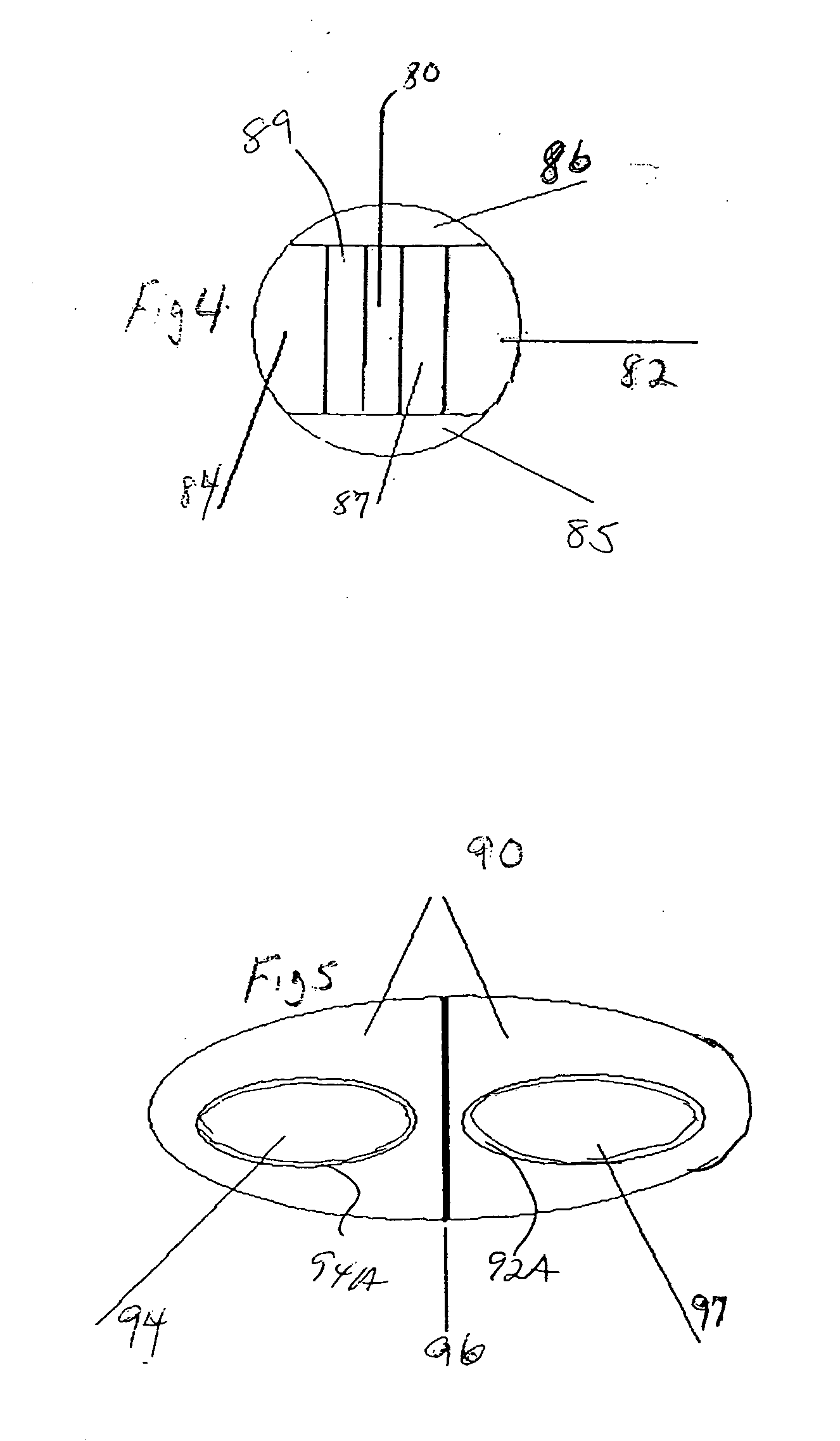 Adhesively bonded dosage form