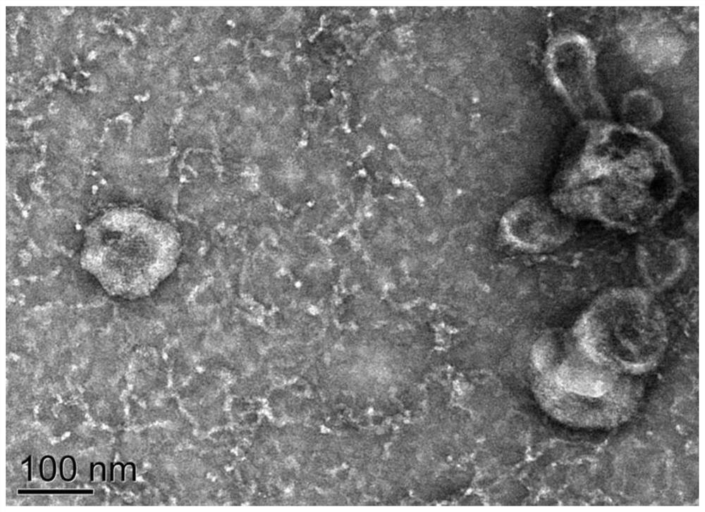 A plasma exosomal tsRNA marker associated with the diagnosis of non-obstructive azoospermia and its application