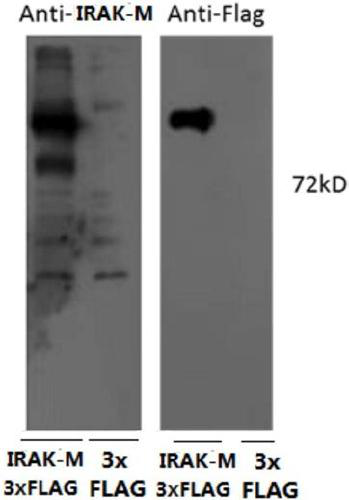 IRAK-M polyclonal antibody and preparation method thereof