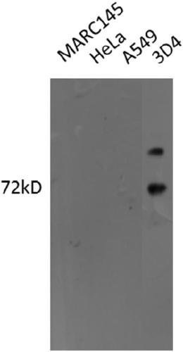 IRAK-M polyclonal antibody and preparation method thereof