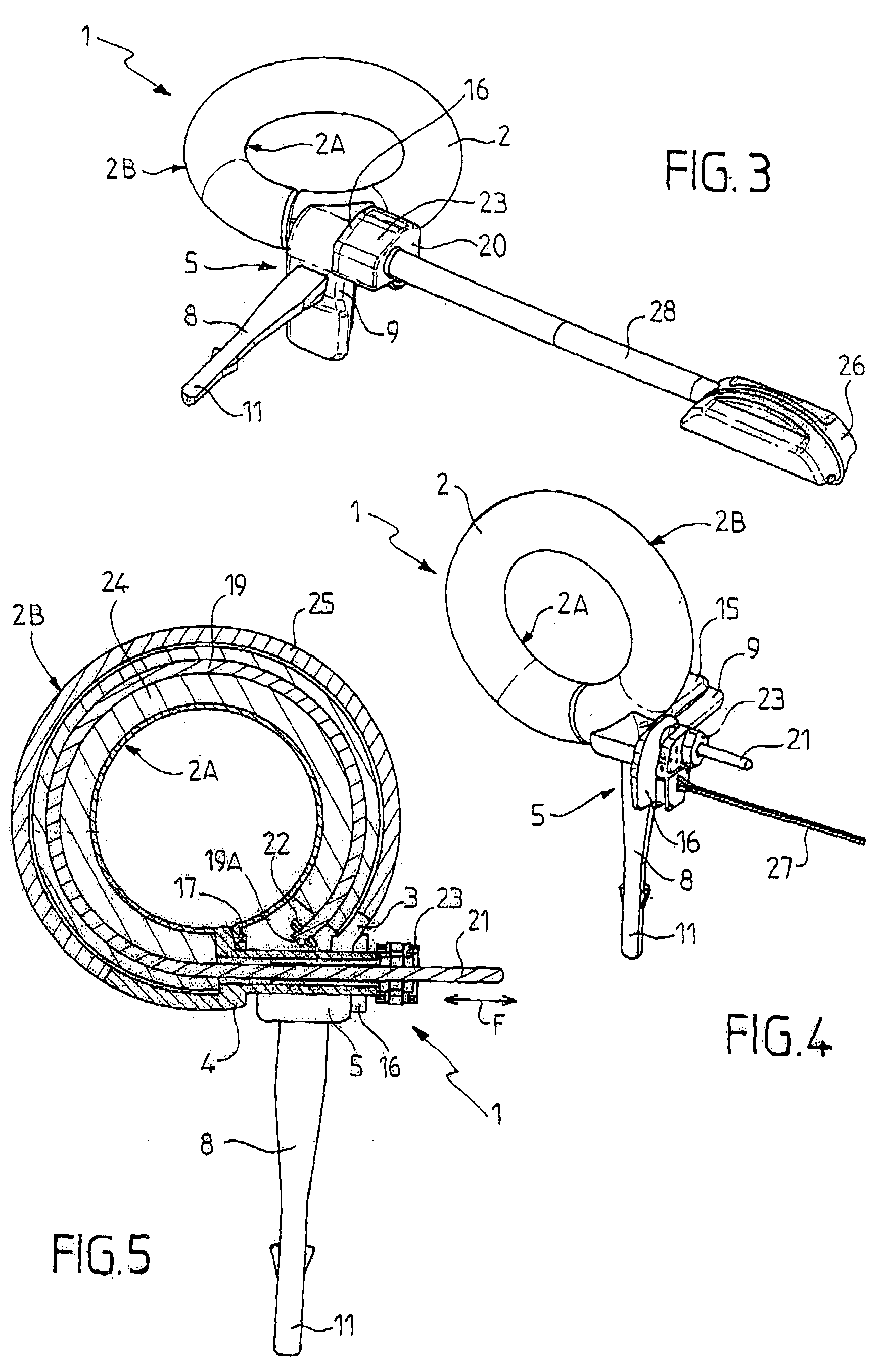 Closure system for surgical ring