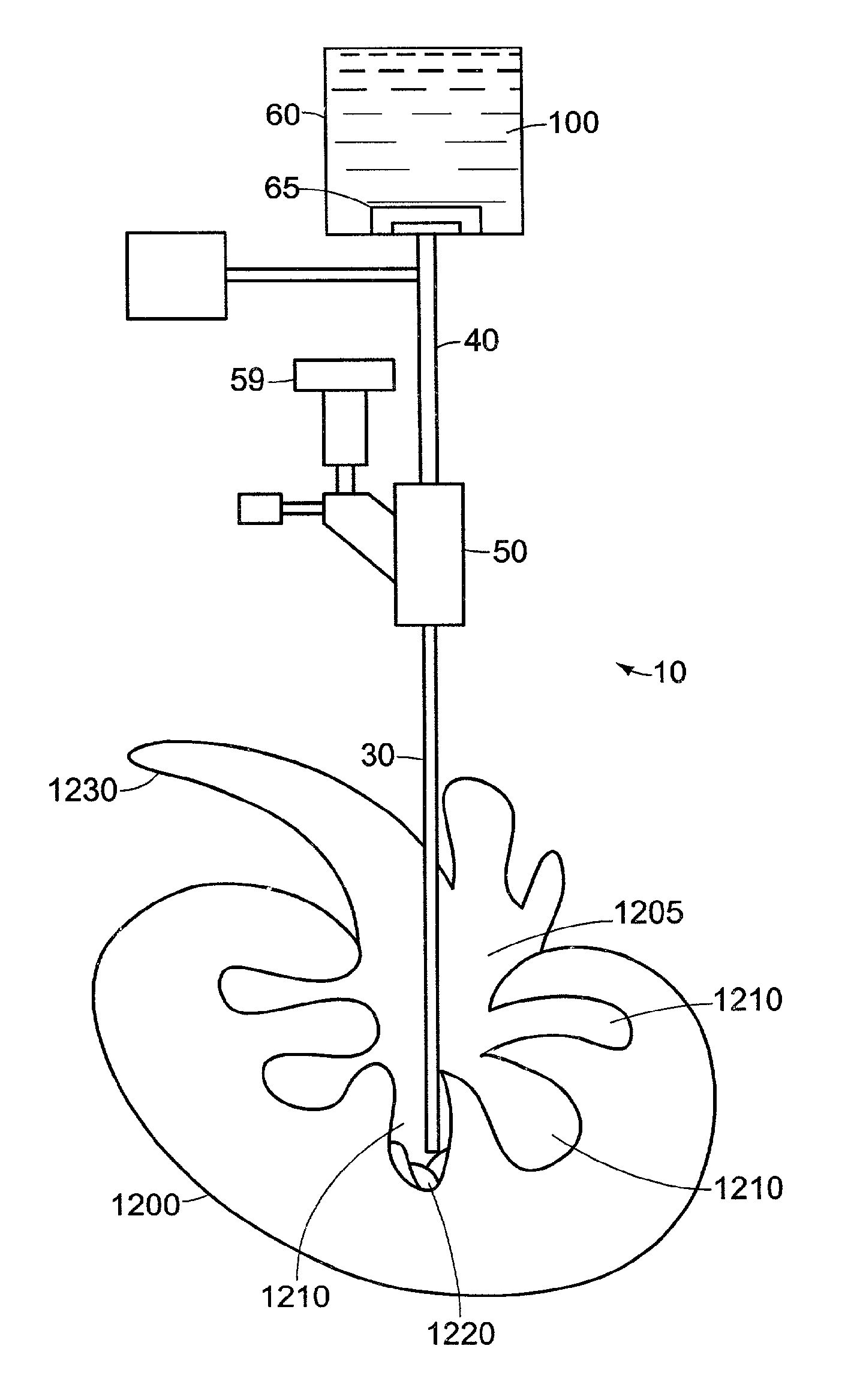 Needle device