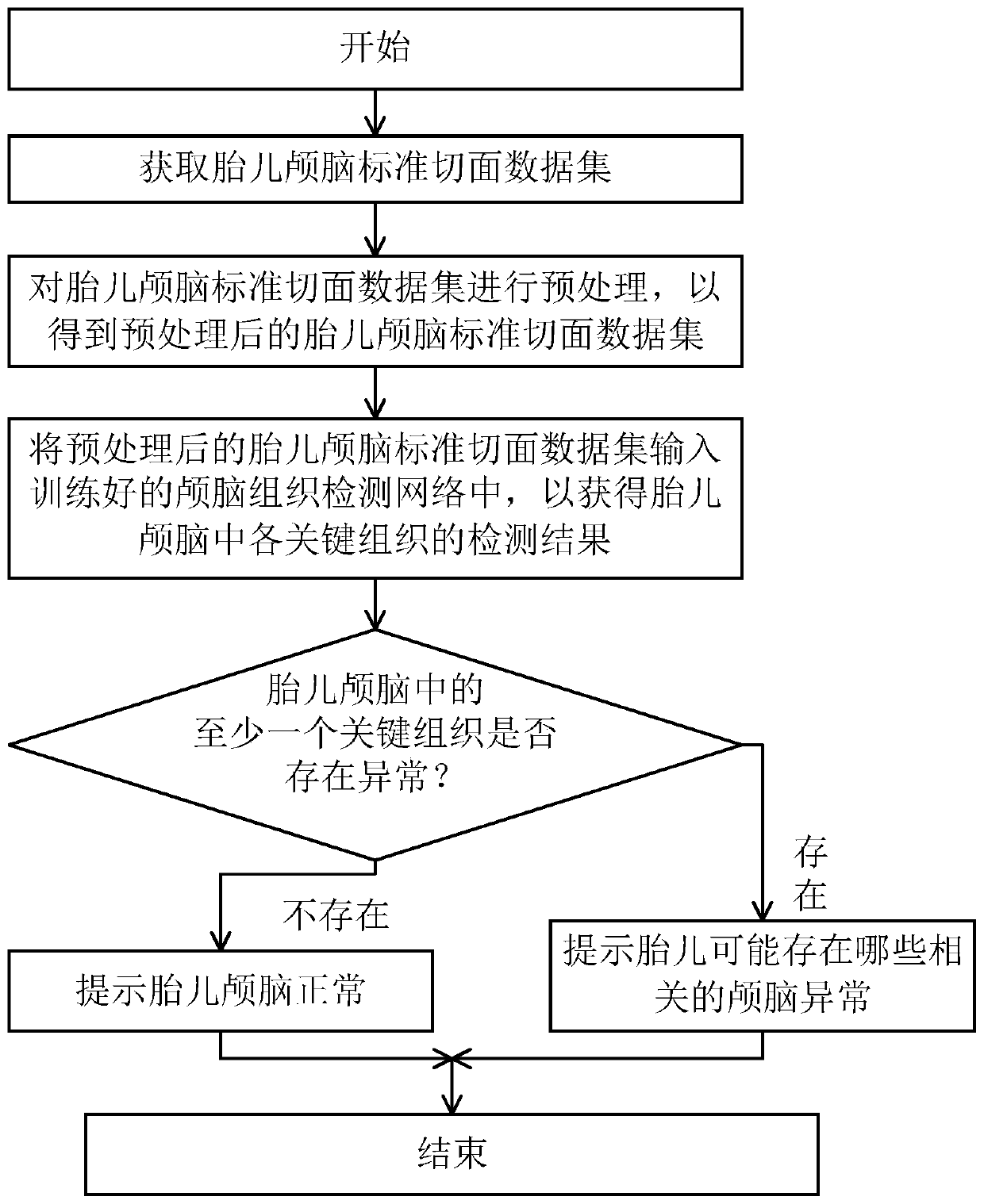 Method for detecting skull abnormity of fetus based on machine learning and system