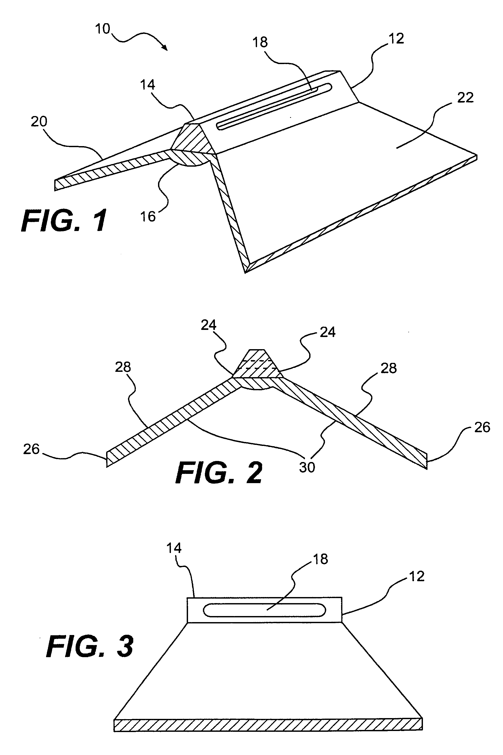 Spinal disc annulus reconstruction method and deformable spinal disc annulus stent