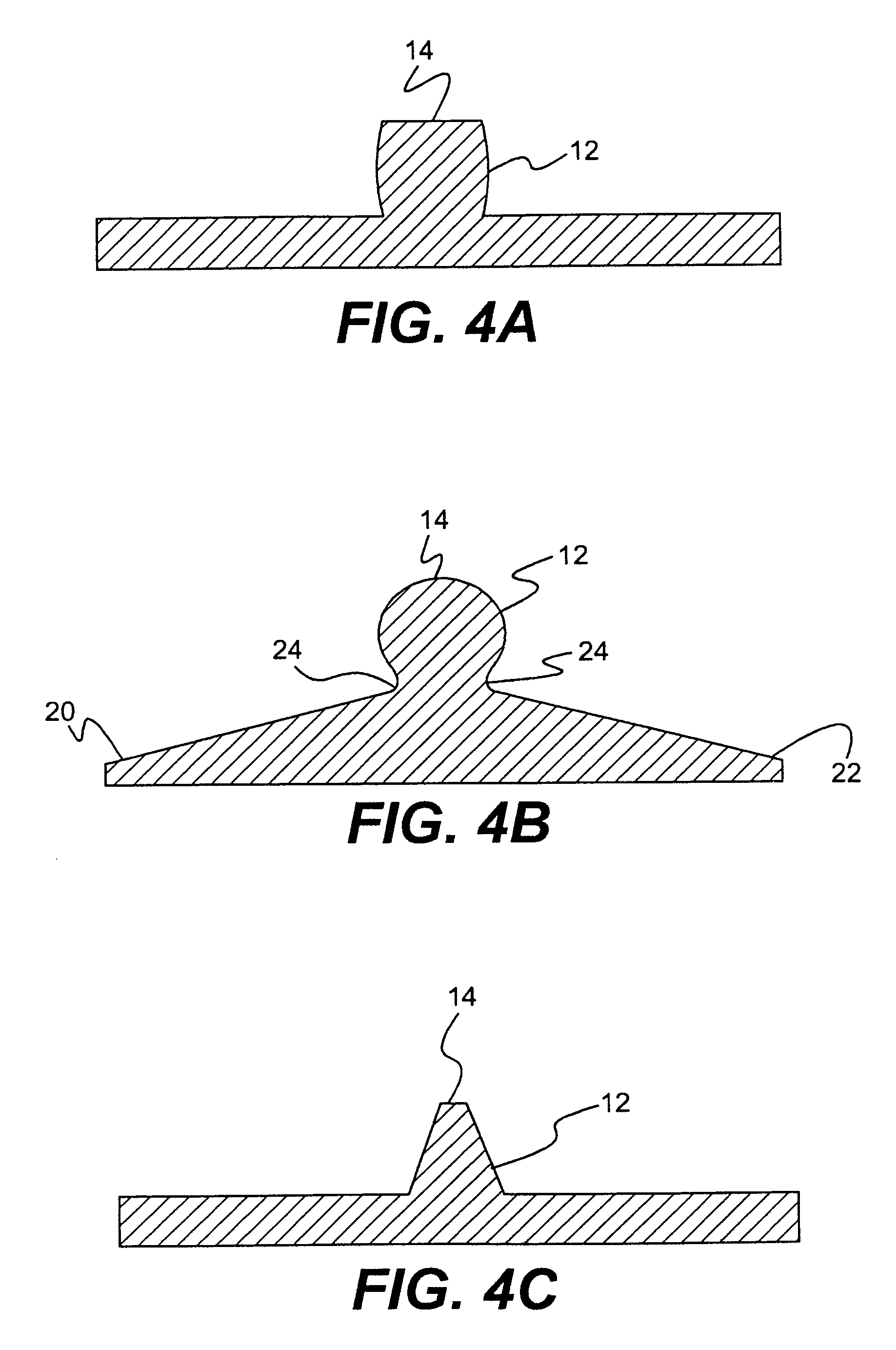 Spinal disc annulus reconstruction method and deformable spinal disc annulus stent