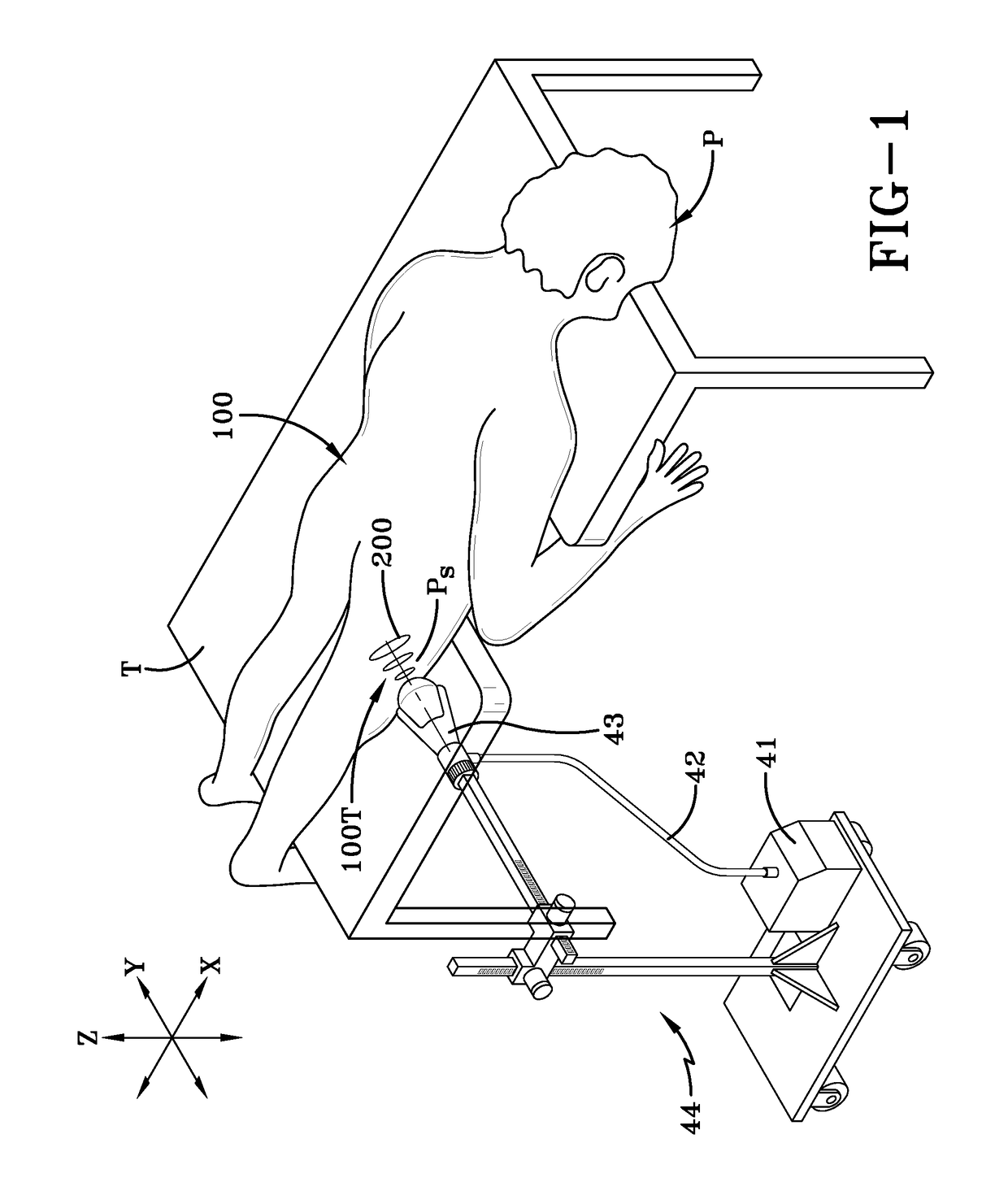 Treatments for blood sugar levels and muscle tissue optimization using extracorporeal acoustic shock waves