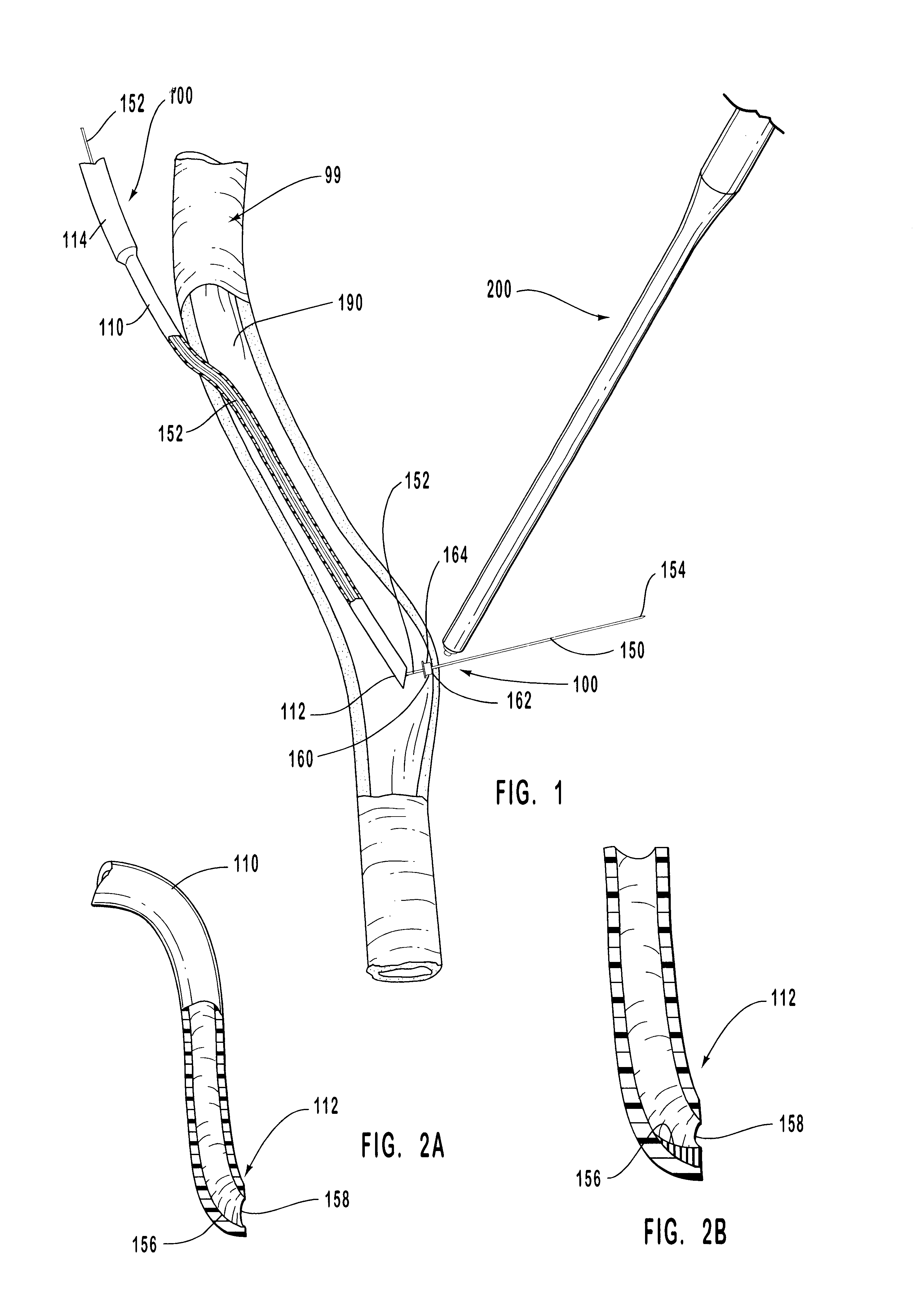 Methods and systems for intraluminally directed vascular anastomosis
