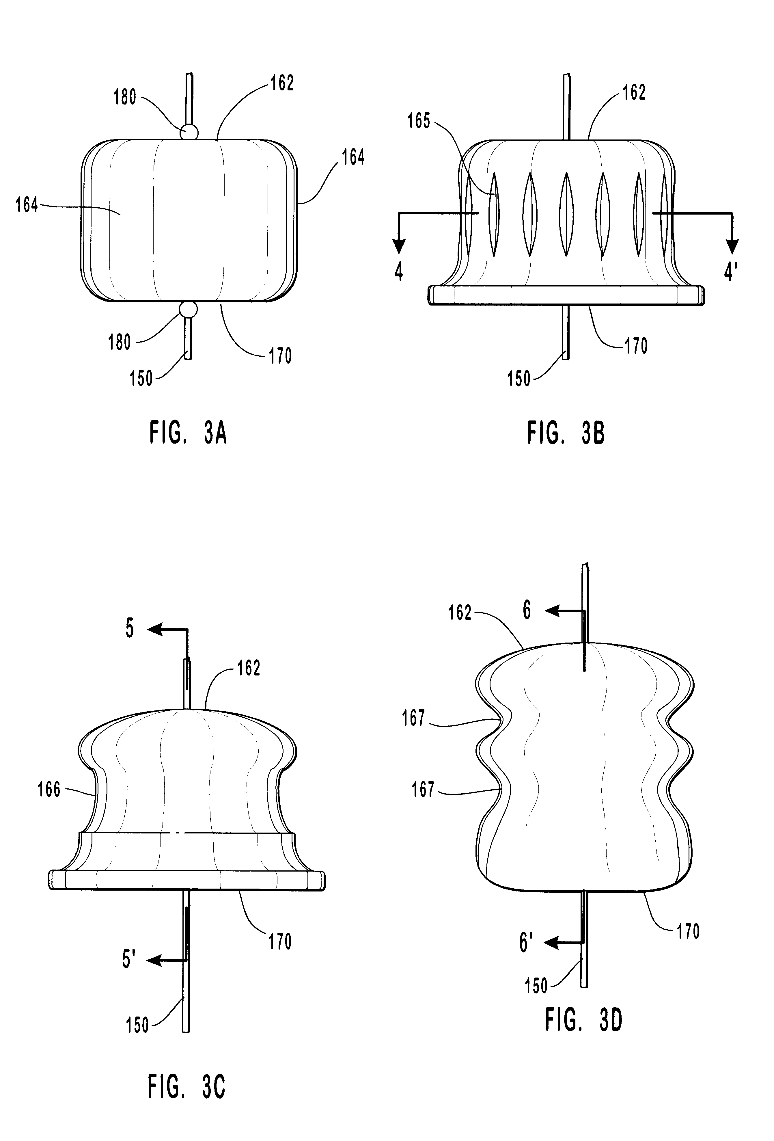 Methods and systems for intraluminally directed vascular anastomosis