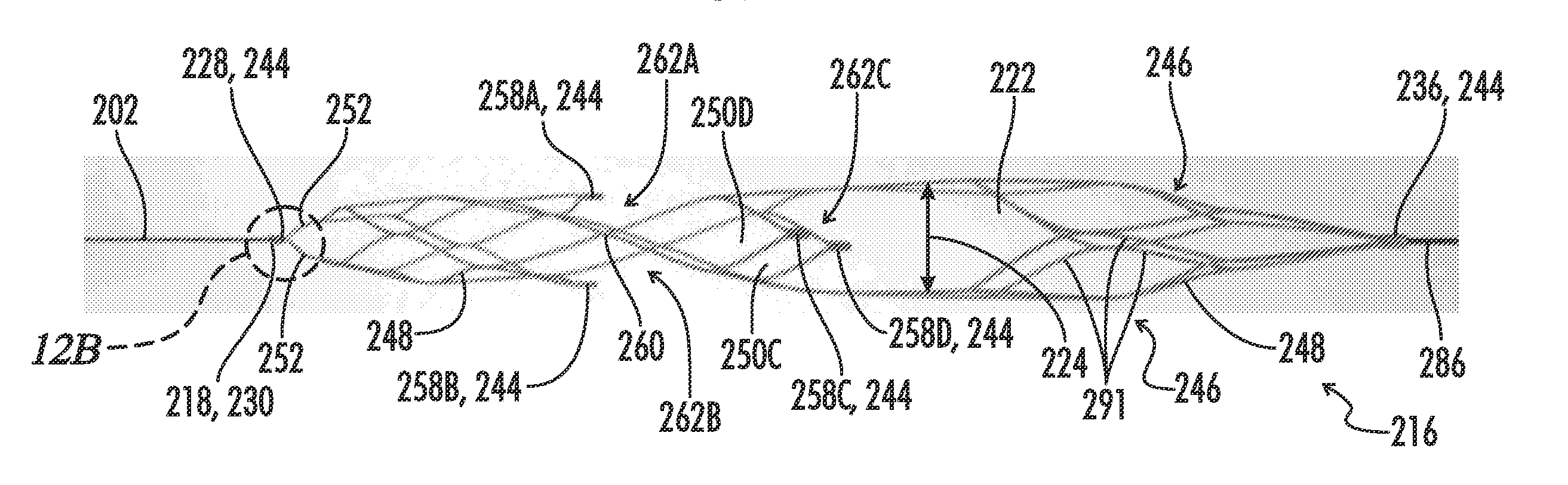 Clot Retrieval System