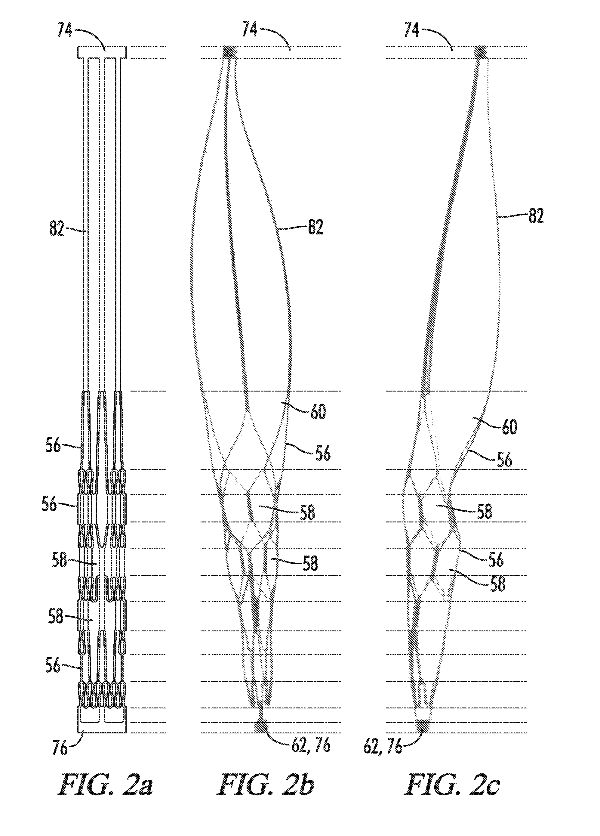 Clot Retrieval System