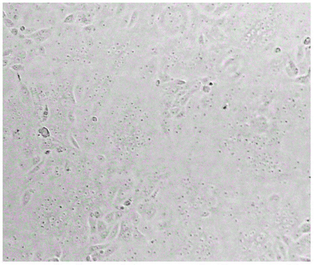 Method for culturing porcine epidemic diarrhea virus