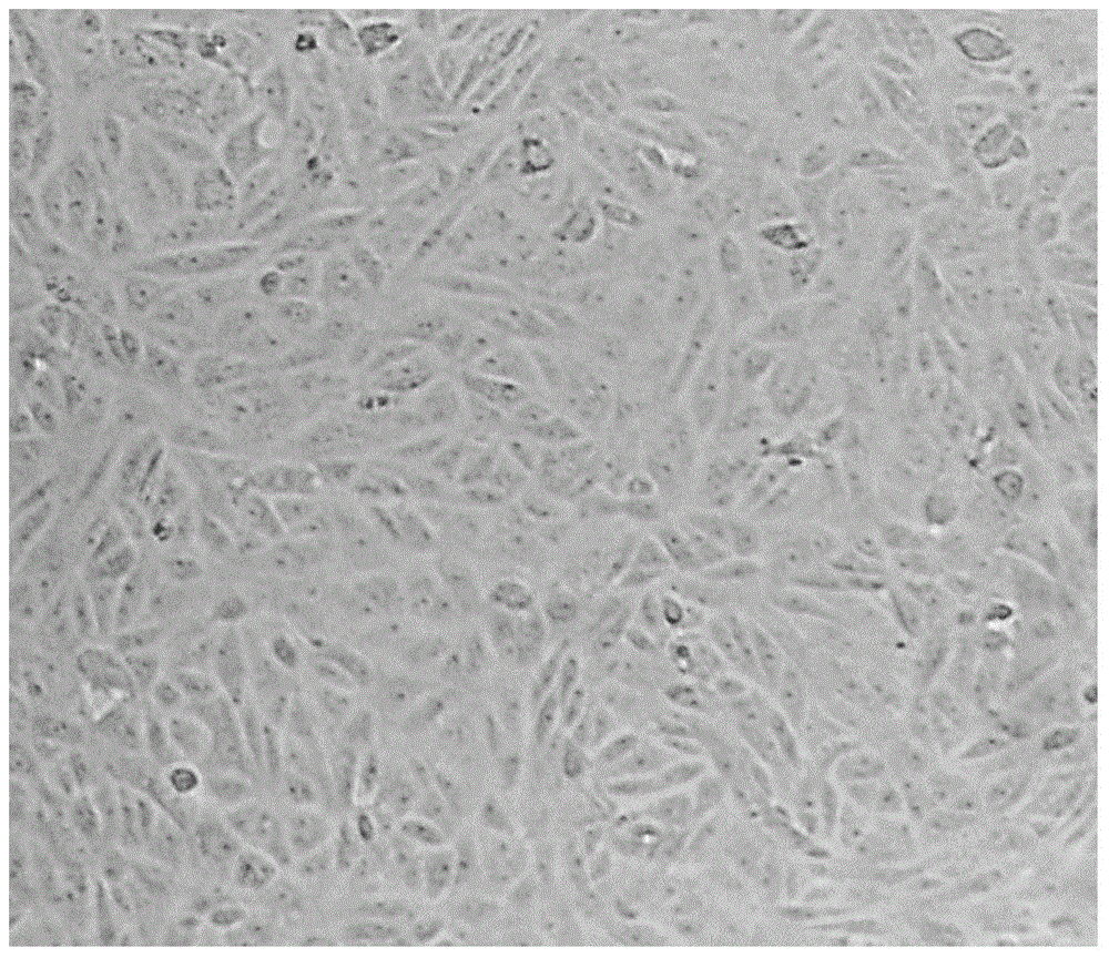 Method for culturing porcine epidemic diarrhea virus